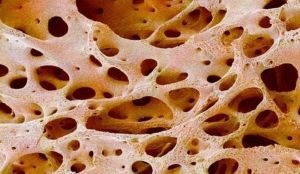Tkivo kostiju