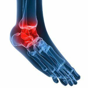 tendonitis of the ankle