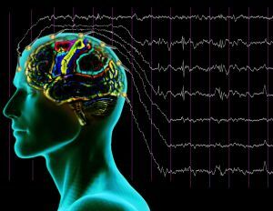EEG do cérebro
