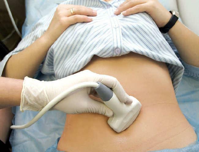 Negimdinis nėštumas ir hCG parametrai