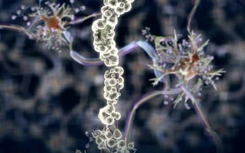 Het is vastgesteld dat in het geval van de ziekte van Alzheimer het bèta-amyloïde eiwit zenuwcellen van de hersenen vernietigt