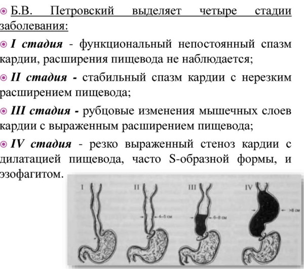 Insufficiency of the cardia and pylorus of the stomach. What is it