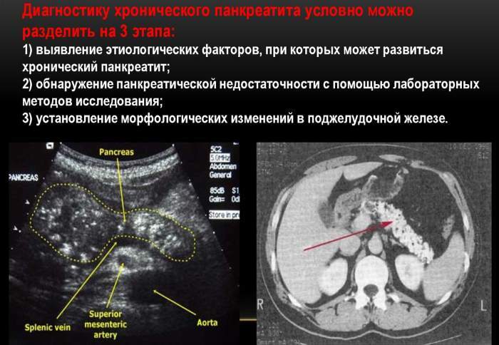 Temperature with pancreatitis in adults, children in the evening. Why maybe what to do