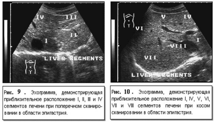 Segmenti di fegato su sezioni ecografiche, TC, RM. Schema, foto