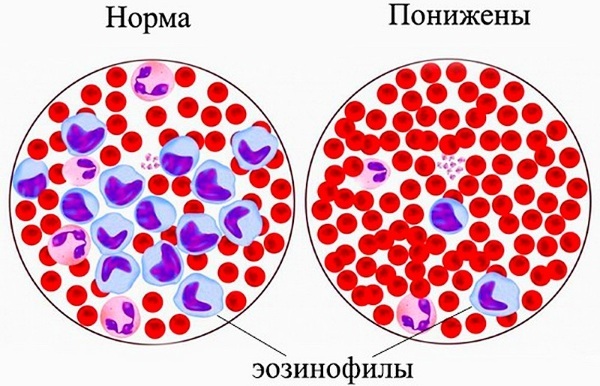 Eosinophils are lowered in a woman, an adult, a child. What does it mean, how to increase