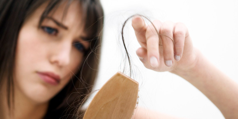 30 vuoden ikäisten naisten hiustenlähtö