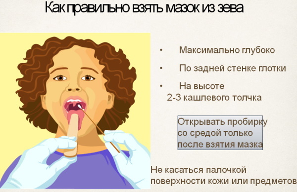 Stomatitis on the gums. Ointments, treatment for children, adults