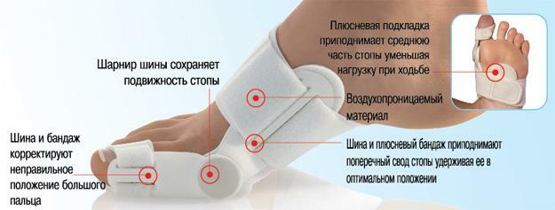 Planos ortopédicos com pés planos transversais