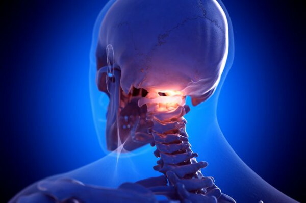 A nyaki csigolya subluxációja egy gyermekben. Tünetek, következmények