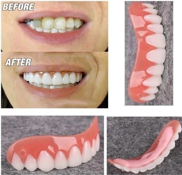 Perfect Smile Veneers. Reviews are real, instructions on how to install