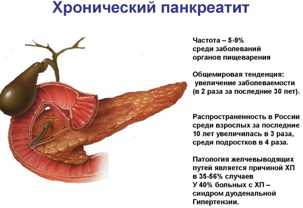 Inflammation of the pancreas. Symptoms and treatment, diet for adults and children