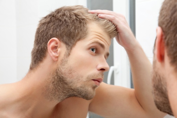 Rambut rontok pada pria di usia muda. Penyebab dan pengobatan