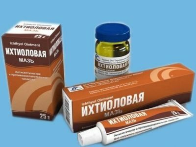 Maza iz analnih razpok: dobra zdravila