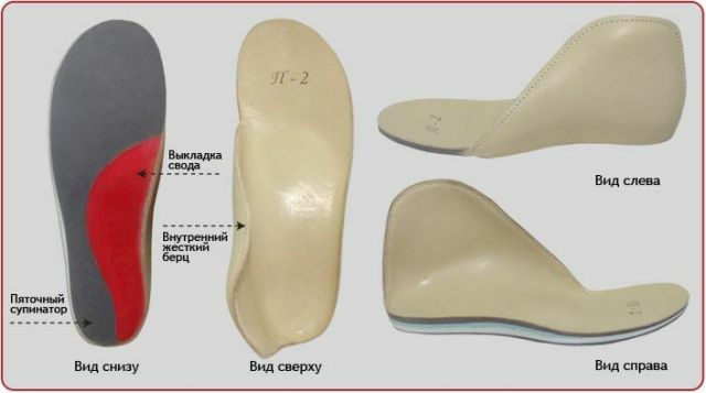 Caratteristiche delle deformità del piede valgo nei bambini: sintomi, trattamento e prevenzione