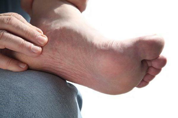Depósito de sal no pé: tratamento e sintomas
