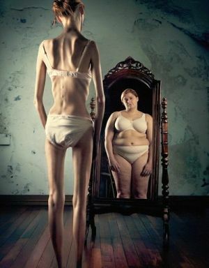 anorexia nervoasă