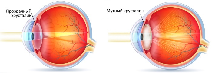 Globo ocular. Cresce desde o nascimento ao longo da vida, estrutura, anatomia
