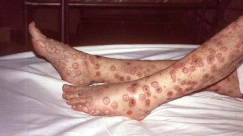 Especially dangerous infections. What is it, what belongs to them
