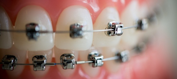 Dentist-ortodont. Ce face un copil, un adult