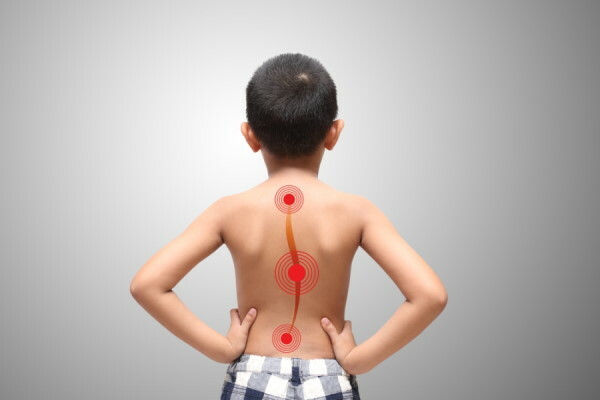 Scoliosis in school-age children. Causes and treatment