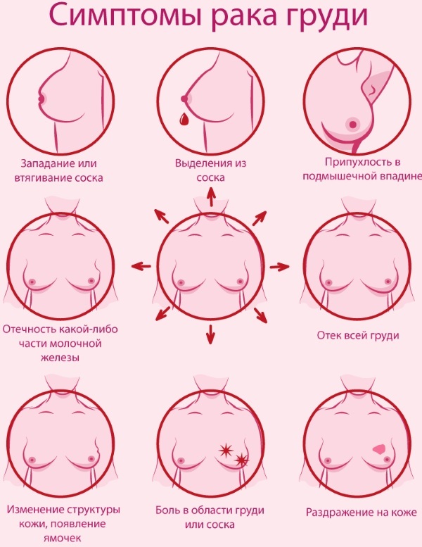 CA 15-3 tumor marker. Norm in women, table, what is it, decoding