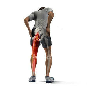 Sciatica is an inflammation of the sciatic nerve