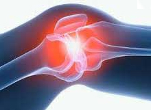 Fluido na articulação do joelho( sinovite): tratamento. ..