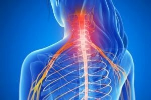 Osteochondrosis צוואר הרחם