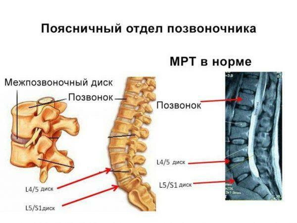 Colonna vertebrale lombare