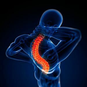 Polysegmentäre Osteochondrose der Wirbelsäule: Details des Hauptteils