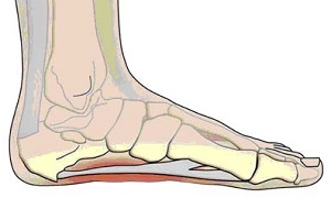 Plantar aponeurosis: symptoms and treatment of inflammation