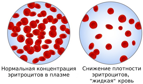 Erythrocytes in the blood are lowered in an adult, a child. What does this mean, the reasons for how to increase