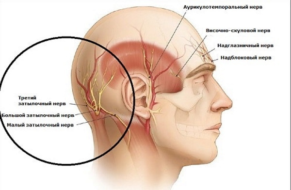 Het hoofd doet pijn in de rug beneden in de buurt van de nek, in de achterkant van het hoofd, braken. Oorzaken
