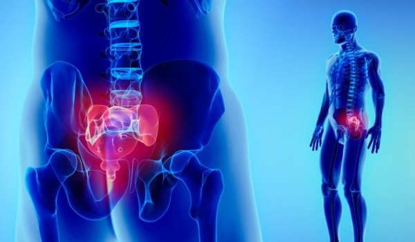 Fracture of the tailbone. Symptoms and consequences in women, child, men, how to treat