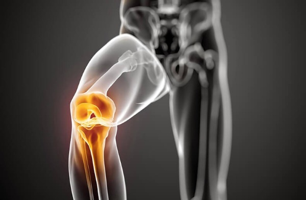La osteoartritis de la articulación de la rodilla de 3 grados. remedios caseros de tratamiento, el láser, en Bubnovskogo, la operación