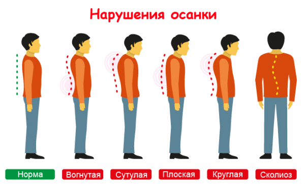 Types de violations de la posture