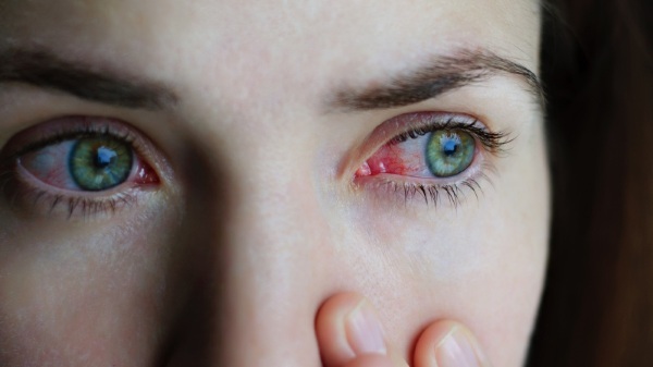 Ofloxacine oogdruppels. Gebruiksaanwijzing, prijs, beoordelingen