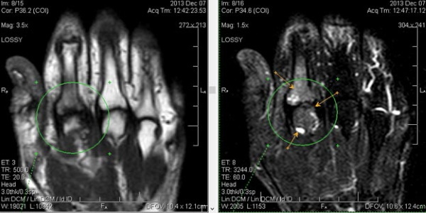 MRI käden. Mikä osoittaa, miten se suoritetaan, hinta, valmistelu