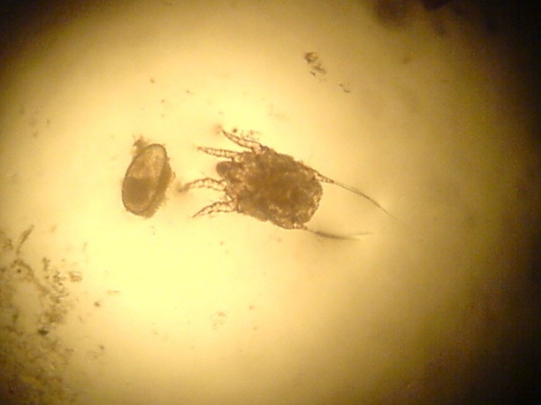 Ear mites in humans. Treatment, how to deal, drops, drugs