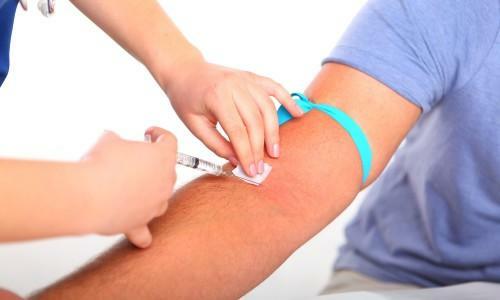 Blood sampling for analysis with arthrosis suspected