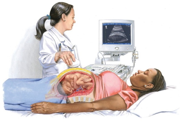 Fetalni distres tijekom poroda. Što je ovo, posljedice