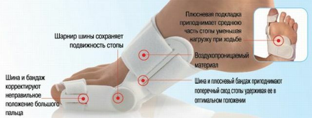 Cum de a detecta și trata artroza articulațiilor degetelor de la picioare în timp?