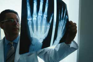 Röntgen voor artrose
