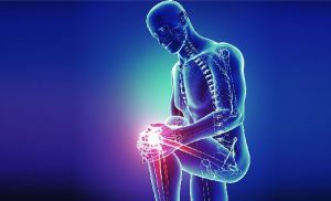 Behandlung von Gonarthrose des Kniegelenks - Medikamente, Chondroprotektoren, Sport und Diät