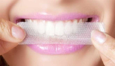 Diş beyazlatma şeritleri