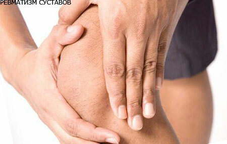 Reumatismo das articulações - sintomas e tratamento, complicações