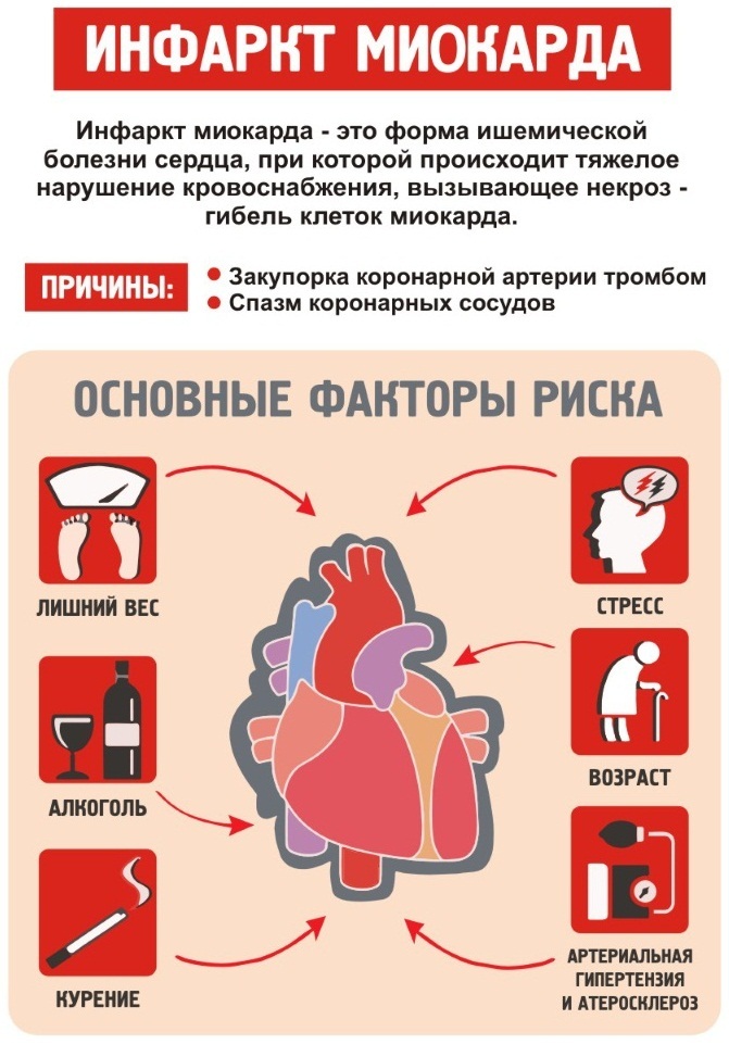 PCI u kardiologiji. Što je to, kako napraviti infarkt miokarda, srčanog udara, akutni koronarni sindrom