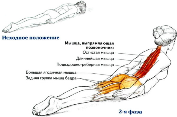 Zovretý nerv v dolnej časti chrbta. Príznaky u žien, liečba