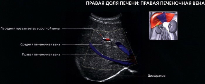 Segmen hati pada bagian ultrasound, CT, MRI. Skema, foto