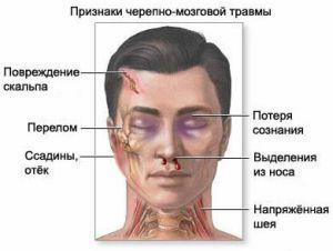 znakove trauma glave